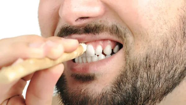 السواك يزيل التكلسات والبقع الصفراء على الأسنان

