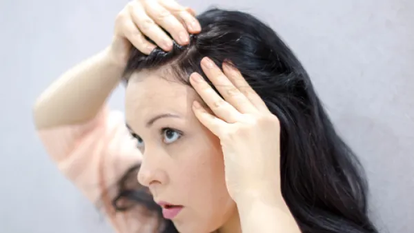 يعمل زيت شجرة الشاي على تقليل إفراز الزيوت الزائدة في فروة الرأس

