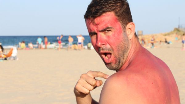 يخفف الخيار من حروق الشمس، والألم الناتج عنها، ويرطب الوجه أيضاً