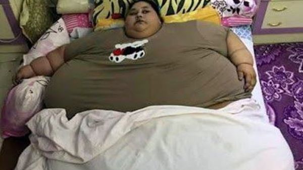 Eman Ahmed, 36, believed to be the world's heaviest woman, was unable to move for the past 25 years. (Twitter)