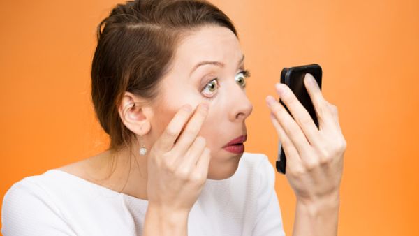 من الأسباب التي تؤدي إلى انتفاخ العين هو العامل الوراثي
