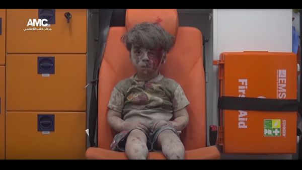 The image of an injured Syrian boy in Aleppo presently going viral (Aleppo Media Center)