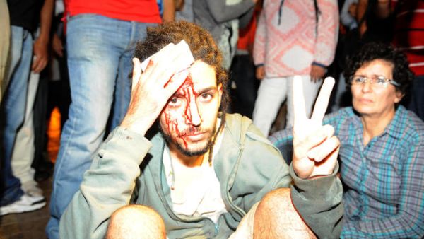 A protester injured during a demonstration on August 2, 2013 in Rabat-Morocco on the release of a Spanish pedophile (AFP/FADEL SENNA)