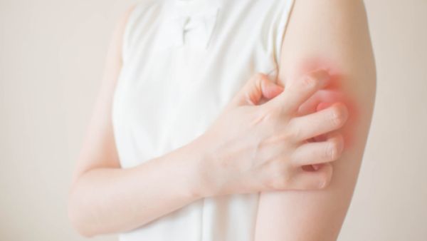 من أسباب الطفح الجلدي التعرّض لمستحضرات التجميل الخاصّة بالأطفال
