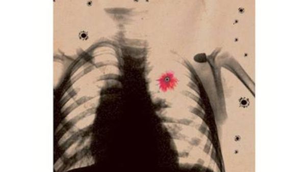 The Syrian artist says his works are a way of voicing his pain