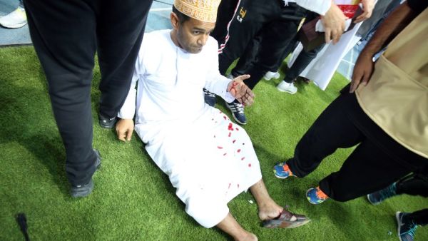 A wounded fan awaits treatment after a glass barrier broke at the end of the Gulf Cup of Nations 2017 final football match between Oman and the UAE at the Sheikh Jaber al-Ahmad Stadium in Kuwait City on January 5, 2018.
Yasser Al-Zayyat / AFP