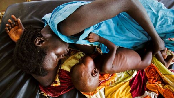 This file photo taken on October 11, 2016 shows a mother breastfeeding her child who suffers acute malnutrition at the clinic run by Doctors Without Borders (MSF) in Aweil, northern Bahr al-Ghazal, South Sudan. (AFP/Albert Gonzalez Farran