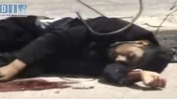 لقطة من فيديو بثتها شبكة شام تظهر جريحا في احد شوارع درعا