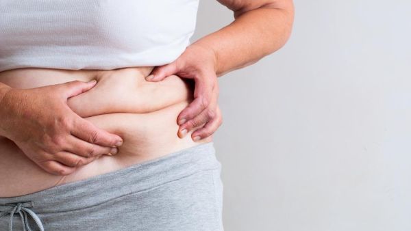 Weight loss surgery is a growing trend in Jordan. (Shutterstock)