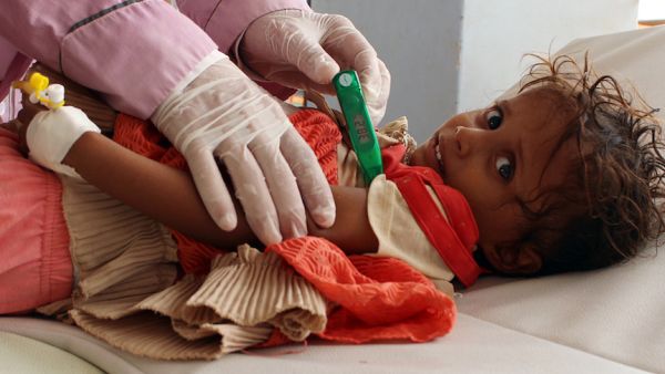 A doctor treats a Yemeni child infected with cholera at a makeshift hospital operated by Doctors Without Borders in Yemen’s Hajjah province. (AFP/ File Photo)