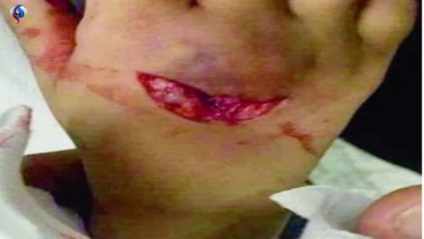 ذئب مفترس ينهش طفلا داخل مول شهير بعرعر