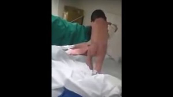 طفلة ولدت وهي "تمشي" 