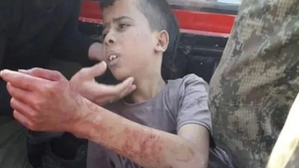 طفل بريء لم يتعد الـ12 من عمره في حلب