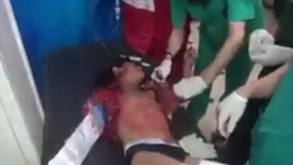 قال ناشطون إن شقيقي الطفل قتلا في القصف الصاروخي لنظام الأسد - يوتيوب
