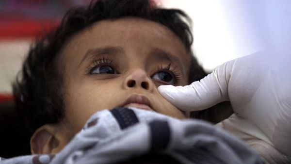 تقدر الأمم المتحدة أن هناك قرابة 600 ألف مدني يعيشون في الحديدة والمناطق القريبة
