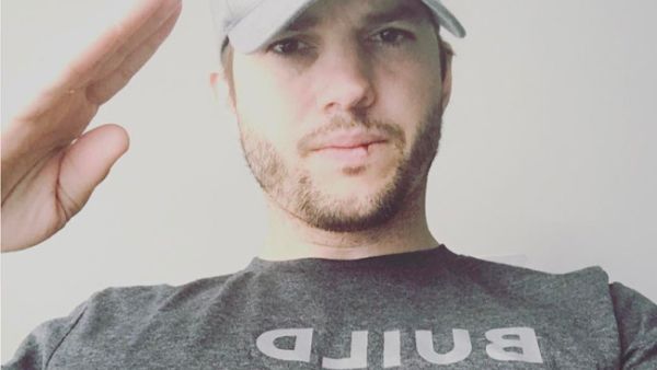 The teenager suffered a grazed knee (Source: aplusk / Instagram )