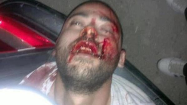 صورة متداولة لجثة الفنان محمد رافع