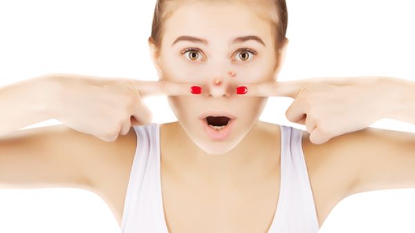 الرؤوس السوداء من المشاكل التي يُعاني منها معظم الرجال والسيدات خاصة

