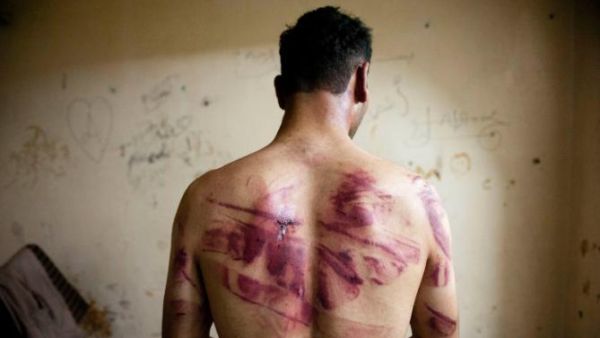 A Syrian man shows marks of torture on his back, after he was released from regime forces, in the Bustan Pasha neighborhood of Syria's northern city of Aleppo on August 23, 2012 (AFP/James Lawler Duggan)