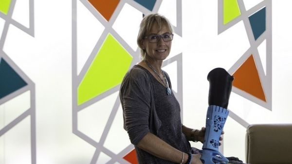 تم تصميم الساق الصناعية لبريطانية مقيمة في دبي كانت قد فقدت ساقها في حادث قبل سنوات