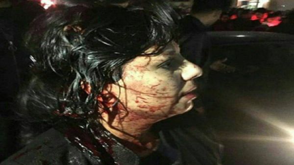  تعليمات الحكومة للحرس الثوري بالضرب بشدة ضد المتظاهرين، وتهديدات القضاء بعقوبات قاسية، أمر غير مقبول