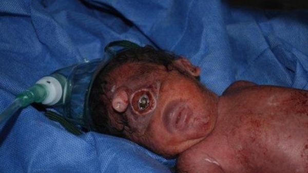 The Iraqi baby