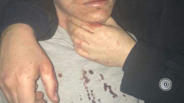 قامت الشرطة بعد القبض على الإرهابي المذكور بحملة مداهمات