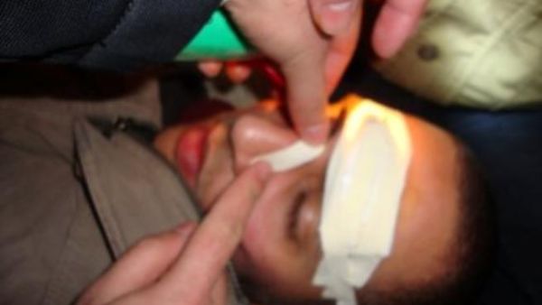 احد المصابين- عن موقع عمان نت