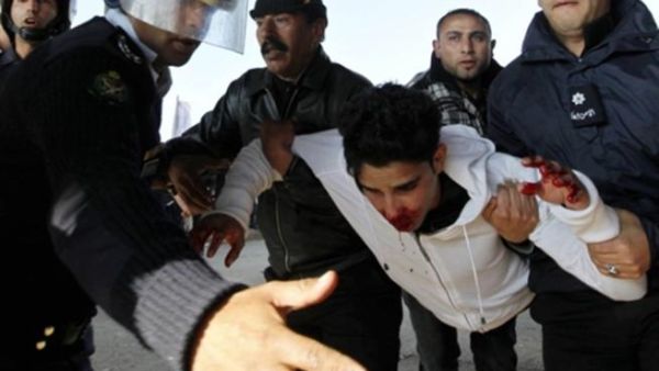 أحد جرحى إعتصام ميدان جمال عبد الناصر