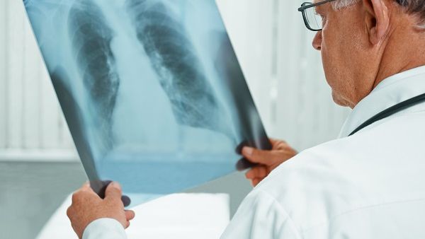 A chest x-ray is one of the best tests for diagnosing pneumonia, HMC experts say. 