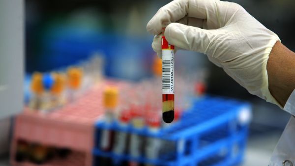 Learning the results of this medical blood test may impose an expiry date on your life.