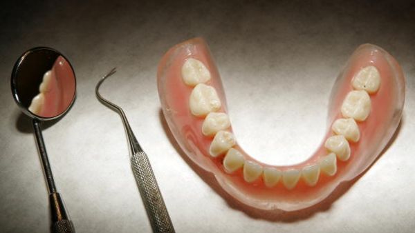 التهاب اللثة، فيمثل المرحلة الأولى لمرض ما حول الأسنان الذي يحصل نتيجة لظهور plaques أو قشور التي ليست سوى رواسب لزجة من البكتيريا والمخاط وفضلات الطعام التي تلتصق بالأسنان، فتتراكم وتسبّب التهابات