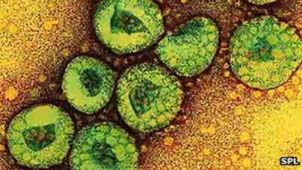 A microscope slide of the deadly SARS virus.