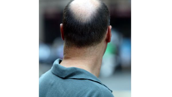 Is the UAE water making hair both shine and shed?