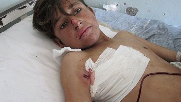 مقتل عشرة اطفال في غارة جوية للاطلسي 