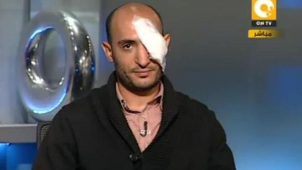 Reports state that the military have been ordered 'to shoot to blind': a policy that might explain the excessive number of eye injuries coming out of this tragic Tahrir saga. 