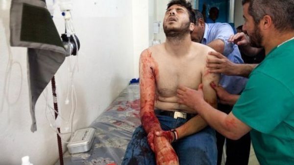 مقاتل في صفوف الجيش السوري الحر يتلقى العلاج في احد مستشفيات القصير 

