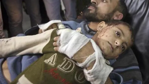فلسطيني وابنه أصيبا في غارة اسرائيلية على قطاع غزة يوم الاثنين
