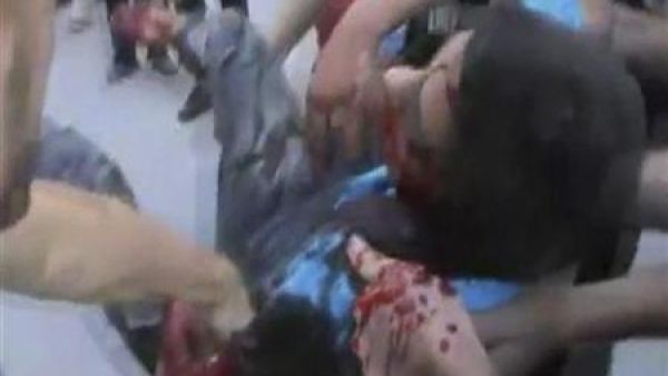 مصاب خلال احتجاج في حمص
