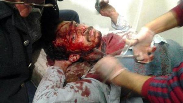 رجل جريح جراء قصف الجيش لحمص يتلقى العلاج في مركز طبي في حي الخالدية في حمص يوم السبت. 