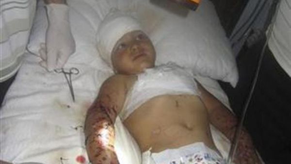 صورة أرشيفية لطفل أصيب في قصف يتلقى العلاج في مستشفى متنقل بالحولة قرب حمص