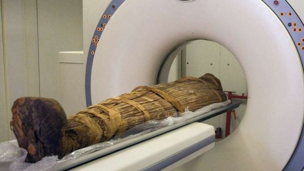 Researchers have found that long before the Western diet of red meat, fat and salt, ancient hunter-gatherers also suffered from clogged arteries.