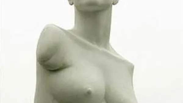 Phocomelia a rare medical condition where from birth the patient has no limbs. This marble statue is of the courageous now famous Alison Lapper, mother and active member of society born with the condition.