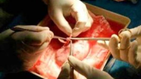 Organ traffickers take advantage of Yemen's harsh economic conditions