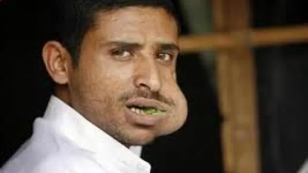 Qat is both the bane and the boon of the troubled country, Yemen.