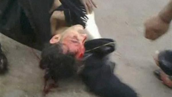 محتج ينزف من جروح في رأسه بعد أن تركه رفاقه على الارض في دمشق للاحتماء من اطلاق النار 
