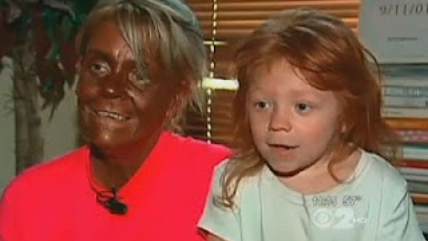 Sometimes a tanning can become an addiction