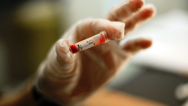 Thalassaemia is prevalent in the Middle East and often exists in your family: It's worth finding out if you're a carrier of this genetic condition before marriage by earlier detection blood tests.