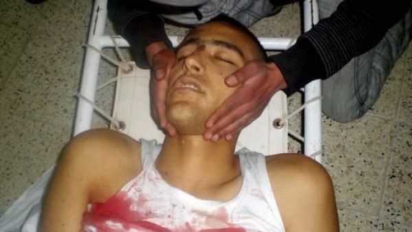 احد ضحايا الاحتجاجات في تونس