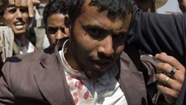 الشرطة اليمنية تقتل ثلاثة محتجين